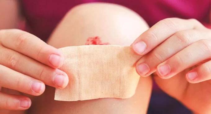 রক্তপাত বন্ধ করার ঘরোয়া ৫ উপায়