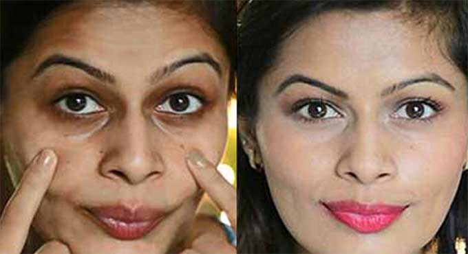 মুখের ত্বকের কালো দাগ দূর করতে করণীয়