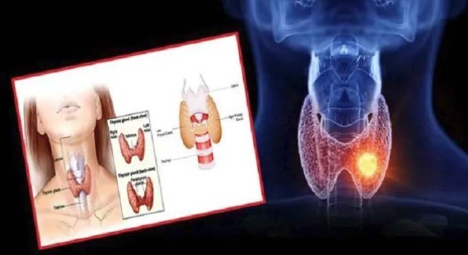 হরমোনজনিত রোগের প্রাথমিক সমস্যা জেনে নিন