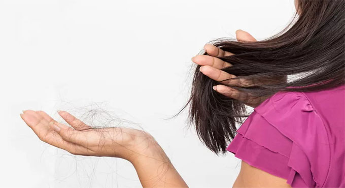 চুল পড়া বন্ধ করার ঘরোয়া উপায় জেনে নিন