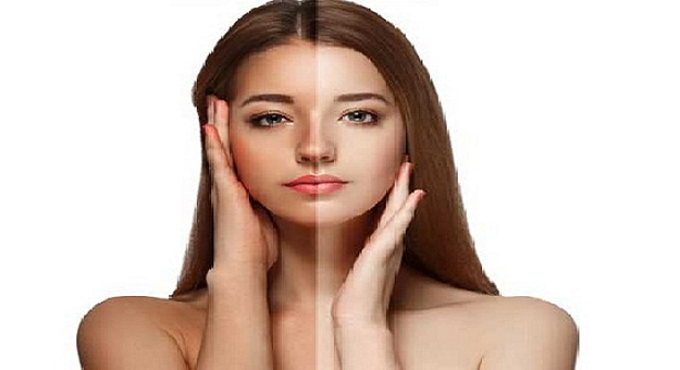 ত্বকের রোদে পোড়া দাগ দূর করার সবচেয়ে সহজ উপায়