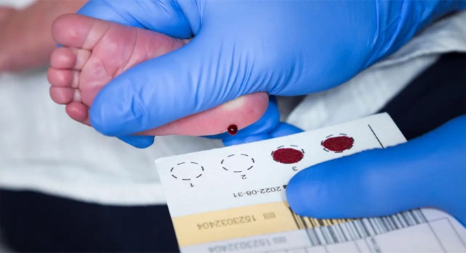 নবজাতকের গোড়ালির রক্ত পরীক্ষায় নির্ধারণ করা যেতে পারে ভবিষ্যৎ রোগ