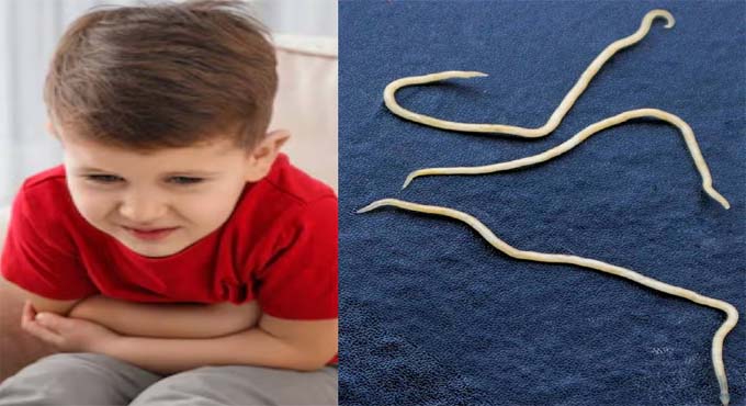 বাচ্চাদের পেটে কৃমি কেন হয়?