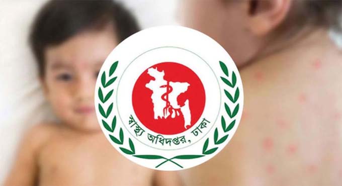 হাম উপসর্গে আরো ৩ জনের মৃত্যু