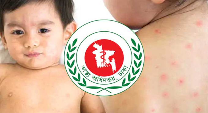 হাম ও উপসর্গে আরো ৫ শিশুর মৃত্যু