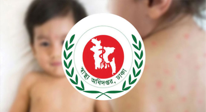 হাম উপসর্গে আরো ৭ শিশুর মৃত্যু